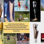 ORTHOFEET REHAB CENTRE