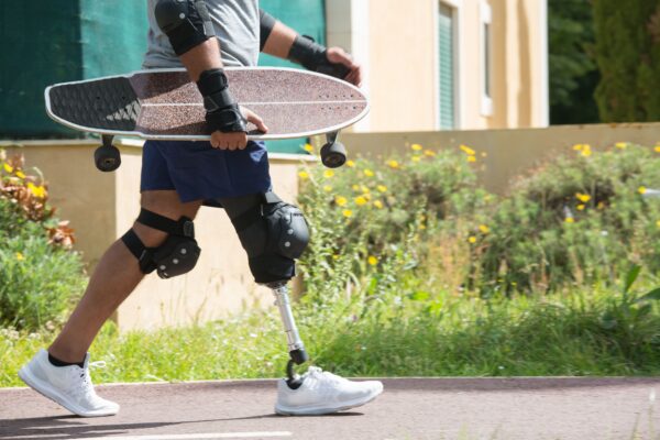 Getting Socket Fit Right: A Practical Guide to Pressure Management in Lower-Limb Prosthetics